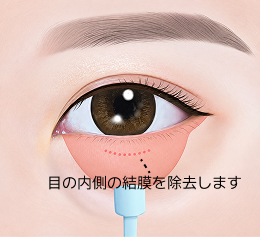 컨텐츠이미지
