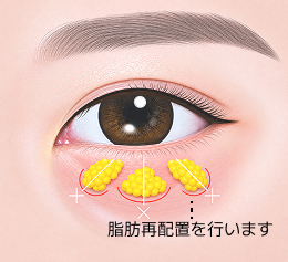 컨텐츠이미지